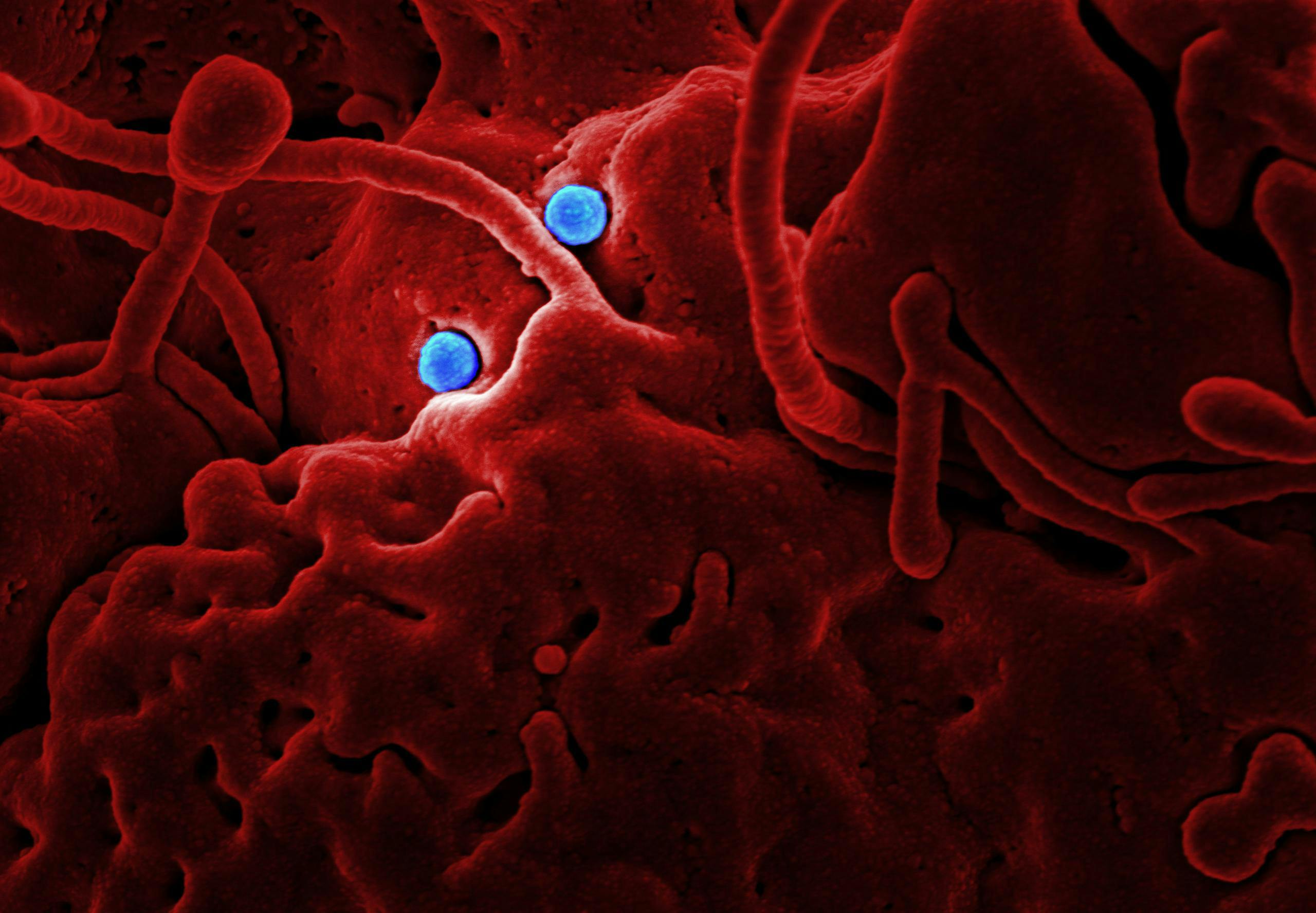 Detailed microscopic image showing red structures and blue virus particles.