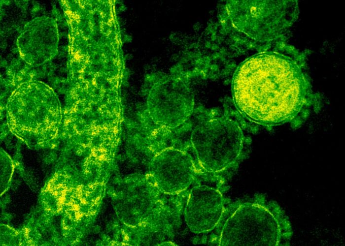 Green-tinted microscopic image of coronavirus particles illustrating viral structures.